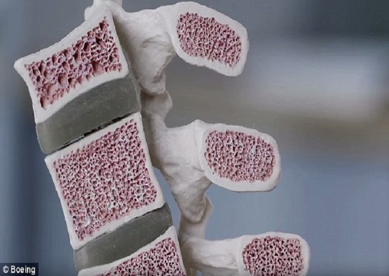 microlattice-inpsired-by-human-bone